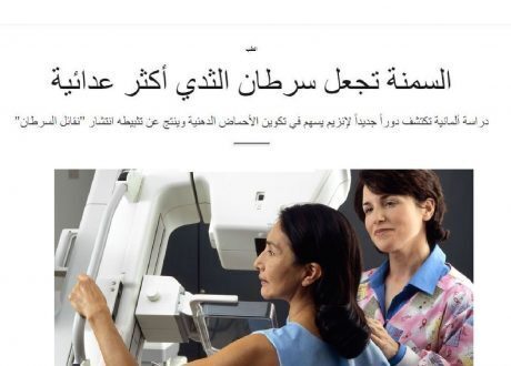 باحثون مصريون ينجحون في علاج سرطان الثدي بالفضة