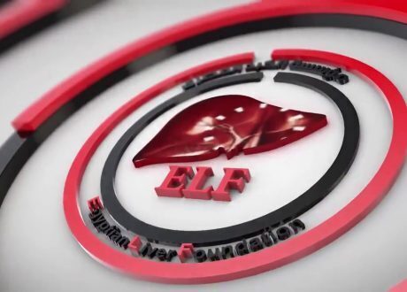 «الصحة» تطلق الحملة القومية بـ17 محافظة للقضاء على فيروس «سي» بحلول 2020