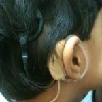 1st cochlear, corneal implantation in Port Said under new health insurance system on July 3