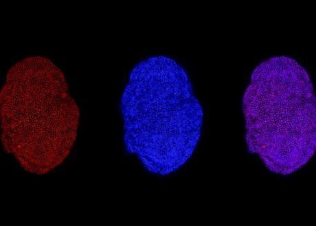 Discovering liver regeneration mechanism opens door for treating chronic liver diseases