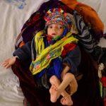 Over 800,000 pneumonia deaths for children under 5 in 2018..African, Asian states most hit