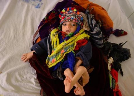 Over 800,000 pneumonia deaths for children under 5 in 2018..African, Asian states most hit