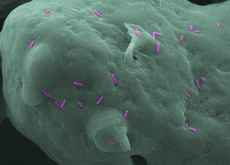 Anti-bacterial 3D printed parts to help limit infections