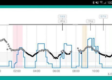 UK launches world’s 1st artificial pancreas app 