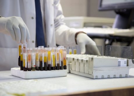UNDP working with partners to back AIDS services