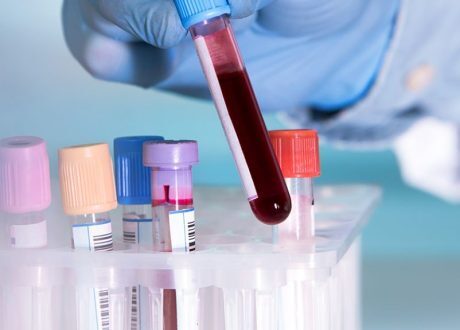 Oxford Univ.  introduces new blood test identifying cancer