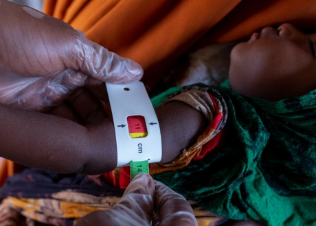 WHO appeals for $123.7 m to prevent food crisis from turning into health crisis 