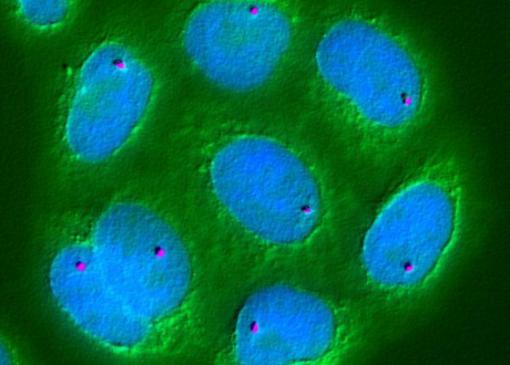EIB provides €22 m to Poland’s Ryvu Therapeutics to develop new cancer treatment