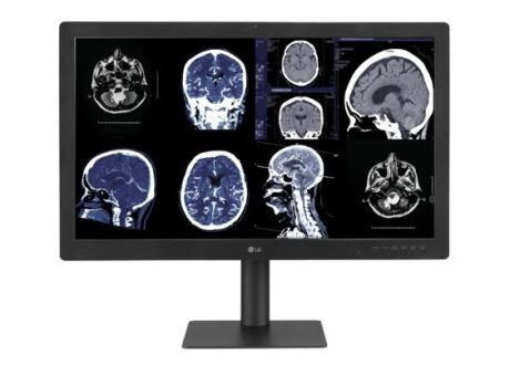 LG launches 1st diagnostic medical monitor with reliable image quality